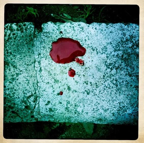 Case #13 — Dream of blood